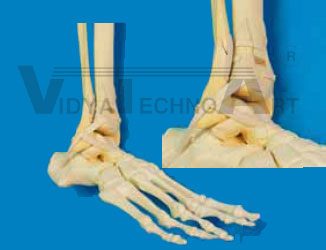 Foot 4-part, fractured